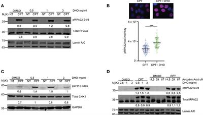 The hydrophilic extract from a new tomato genotype (named DHO) kills cancer cell lines through the modulation of the DNA damage response induced by Campthotecin treatment